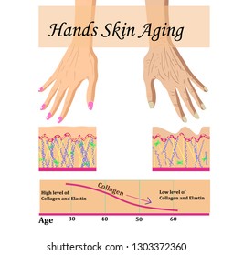 Hands skin aging, vector illustration with a chart