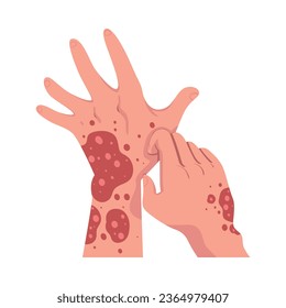 Hands with Skin Problem Suffering from Itching Vector Illustration