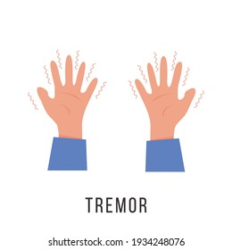 Hands with tremor symptom. Parkinson disease. Trembling or Shivering arms. Physiological stress symptoms. Mental disorders, panic, fear. Vector illustration in flat cartoon style.