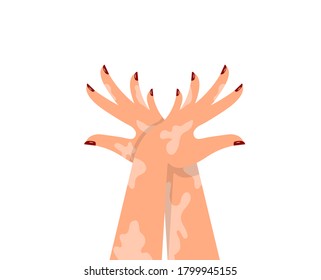 メラニン色素 のイラスト素材 画像 ベクター画像 Shutterstock