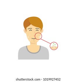 Happy brown hair male or man with clean face without acne after treatment face or beauty care illustration with pore detail diagram