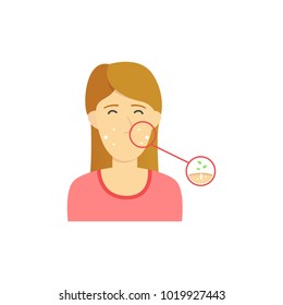 Happy brown hair woman girl with clean face without acne after treatment face or beauty care illustration with pore detail diagram