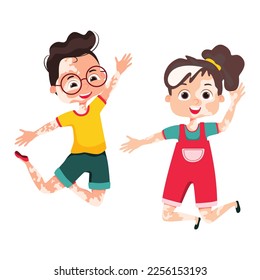Happy children with vitiligo cosmetology skin disease. Two kids with dermatologist spot pigment problem standing together. Body positive illustration. Cartoon Vector illustration
