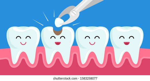 Happy friends healthy teeth sick tooth with hole. Treatment of a diseased tooth with a loba. Kawaii facial expression character. The concept of pediatric dentistry. vector illustration
