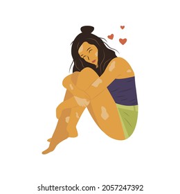 Happy girl with vitiligo sits and hugs herself lovingly. Accept and love yourself. Colorful isolated vector illustration cartoon