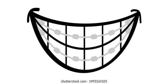 Happy smile with teeth and braces. Orthodontic dental care bracket. Cartoon, flat vector thoughts pictogram. Orthodontic dental care bracket or brace. Teeth dentist, braces