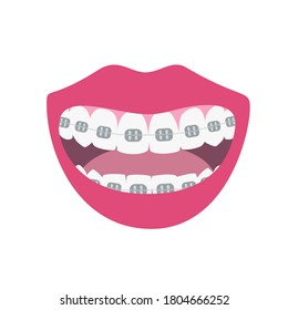 Happy smiles showing alignment and whitening teeth process. Alignment of bite of teeth, dental row  with braces, Orthodontic healthcare  concept. Vector illustration