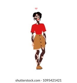 Happy smiling young woman with vitiligo skin disease. Spotted skin with wrong pigmentation girl in skirt, red tshirt, red lipstick. Body positive concept. Vector flat isolated illustration