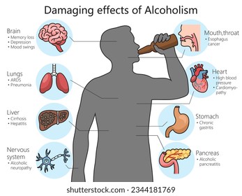 harmful effects of alcohol on the human body diagram schematic vector illustration. Medical science educational illustration