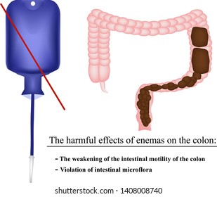 The harmful effects of enemas on the colon in constipation. Feces in the intestines. Infographics. Vector illustration on isolated background.