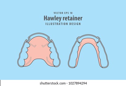 Hawley retainer illustration vector on blue background. Dental concept.