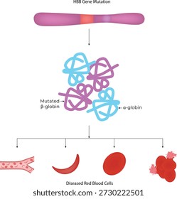 HBB Genmutation und Sichelzellanämie Pathophysiologie Vektorgrafik	