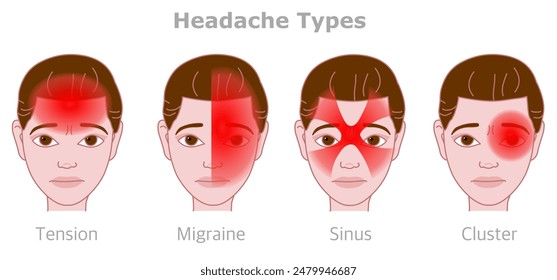 Head, face pains. Headache types. Cluster, sinus, tension, migraine. Different treatment. Sick female cartoon face. Woman face gradient red location, area. Vector illustration
