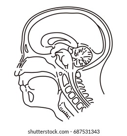 Head illustration of MRI examination