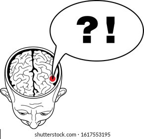 Head of a man with an open brain top view. Tormenting thoughts. Questions and answers. Vector humorous illustration.