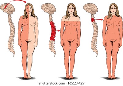 Head and spinal cord injuries paralysis some parts of the body.
