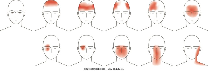 Head where a headache occurs. Image illustration seen from the front.