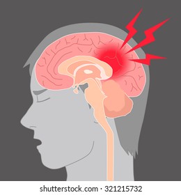 headache, cerebral hemorrhage, brain stroke, image illustration