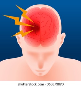Headache, Cerebral Hemorrhage, Brain Stroke, Image Illustration