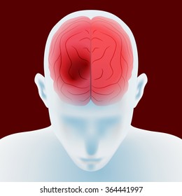 headache, cerebral hemorrhage, brain stroke, image illustration svg