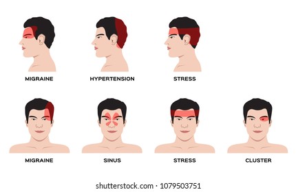 3,450 Types of headaches Images, Stock Photos & Vectors | Shutterstock