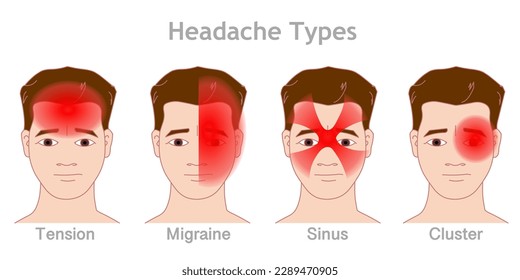 Headache types. Head pain. Tension, migraine, sinus, cluster. Man, boy face gradient red location, area. Different treatment. Sick face male face drawing. Neurology medical illustration vector