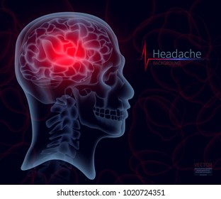 Headache, x-ray of the brain, vector illustration for medicine. A skull frame, A creative creative illustration in a new style of 2018