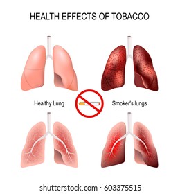 Health Effects Of Smoking. Healthy Lungs And Smokers Lungs. No Smoking Sign. Symbol Flat Icon