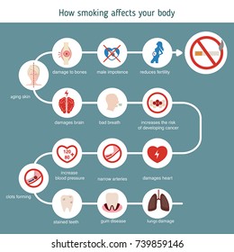 Health Healthcare Infographic Foods That Lower Stock Vector (Royalty ...