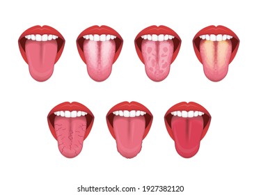 Tongue’s health sign vector illustration set