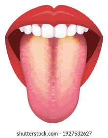 Tongue’s health sign vector illustration ( Yellow coated Tongue )