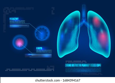 Healthcare futuristic technology Human lungs with COPD chronic obstructive pulmonary disease. Lungs inflammation symptoms causes diagram. Compared healthy airways and emphysema or bronchitis sickness