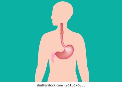 Healthcare infographic depicting esophageal cancer symptoms and anatomy. eps 10
