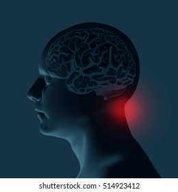 Healthcare and migraine concept - vector illustration
