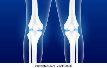 Healthy bone joint knee and cartilage. Human bone leg anatomy on a dark blue background. Medical and science template. Skeleton x ray scan concept. 3D Vector EPS10 illustration.