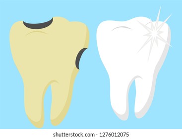 Healthy cartoon tooth and decayed tooth with. Dental care and hygiene infographics. Good and bad for your teeth. Vector illustration isolated on white background