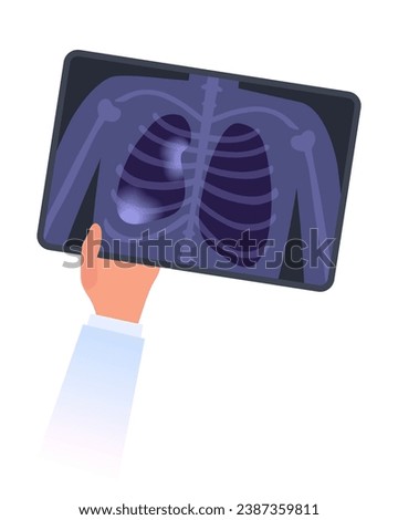 Healthy and collapsed lung x-ray image. Doctor`s hand holds MRI scan of partial closure of a lung. Respiratory failure, Atelectasis or pleurisy disease concept. Chest pain, lungs decrease illustration