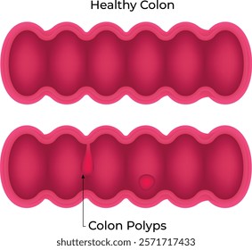 Healthy Colon Science Design Vector Illustration Diagram