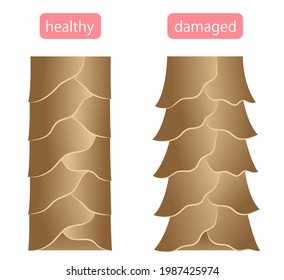 Healthy And Damaged Hair Cuticle Illustration. Hair Care And Beauty Concept