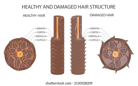 Healthy and damaged hair structure. Layer of healthy and damaged hair structure.  Vector illustration.