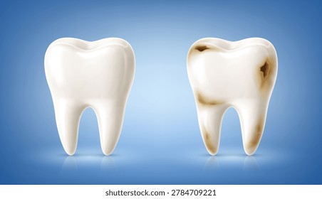 Healthy and decayed human teeth. Dental caries concept. Vector illustration