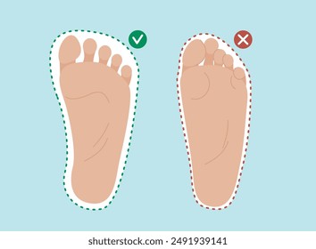 Healthy and deformed human feet comparison. Barefoot shoes vs regular shoes. Vector illustration