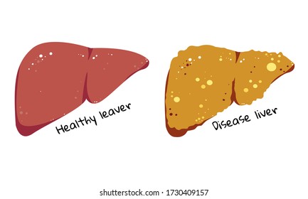 111 Non alcoholic fatty liver disease Images, Stock Photos & Vectors ...