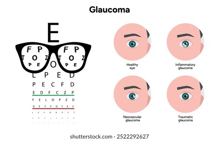 Olho e olho saudáveis com glaucoma. Oftalmologia, exame ocular. Glaucoma inflamatório.
Glaucoma neovascular.
Glaucoma traumático