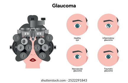 Healthy eye and eye with glaucoma. Ophthalmology eye testing and examination. Inflammatory glaucoma.
Neovascular glaucoma.
Traumatic glaucoma