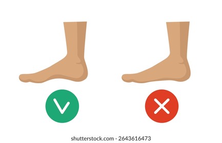 Pé saudável e pé liso. Ilustração vetorial isolada sobre fundo branco.