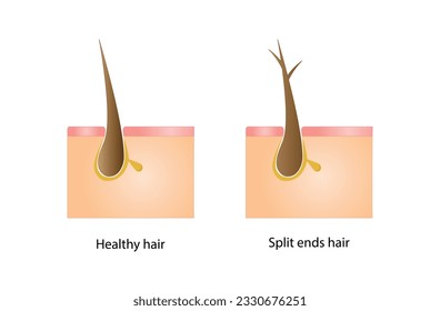 El cabello sano y la división terminan el pelo con fondo blanco. Cuidado del pelo. Problemas de cabello. Ilustración vectorial.