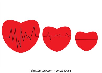 Un corazón sano, un pulso de pulsación, se alineó hacia un corazón cuyo pulso estaba decayendo.