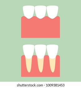 healthy incisor tooth on gum for dental care - teeth cartoon vector flat style cute character for design