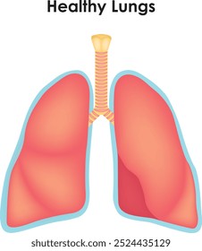 Anatomia Pulmonar Saudável Traqueia Lóbulo Superior Tumor De Brônquio Lóbulo Inferior Lóbulo Médio